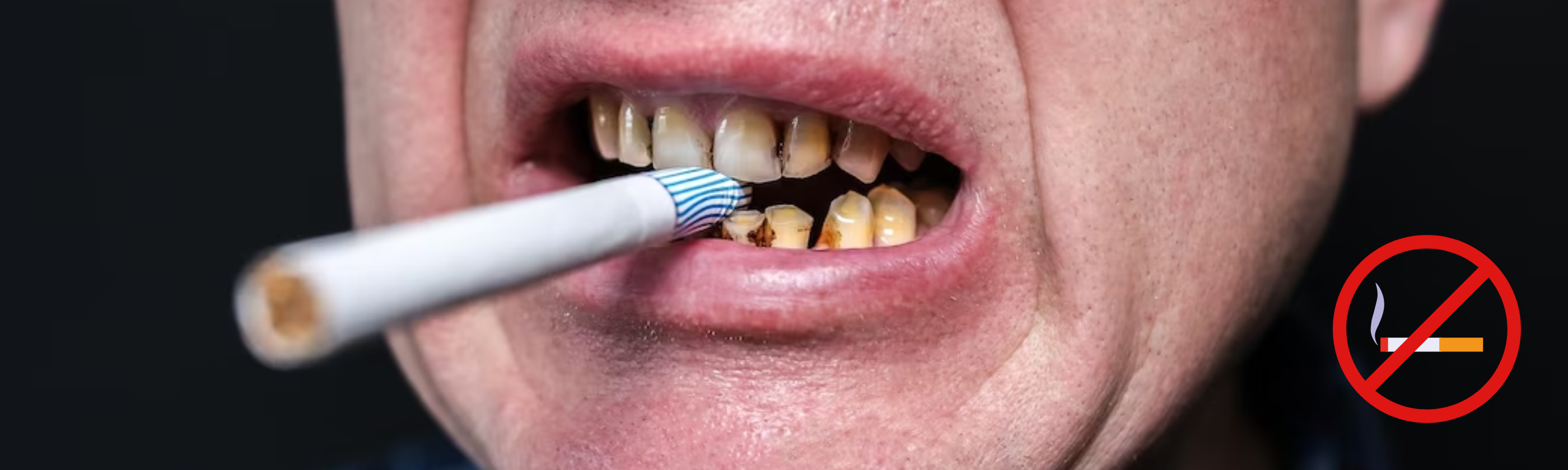 The Impact of Lifestyle Choices on Oral Health: From Smoking to Diet in Indiaa